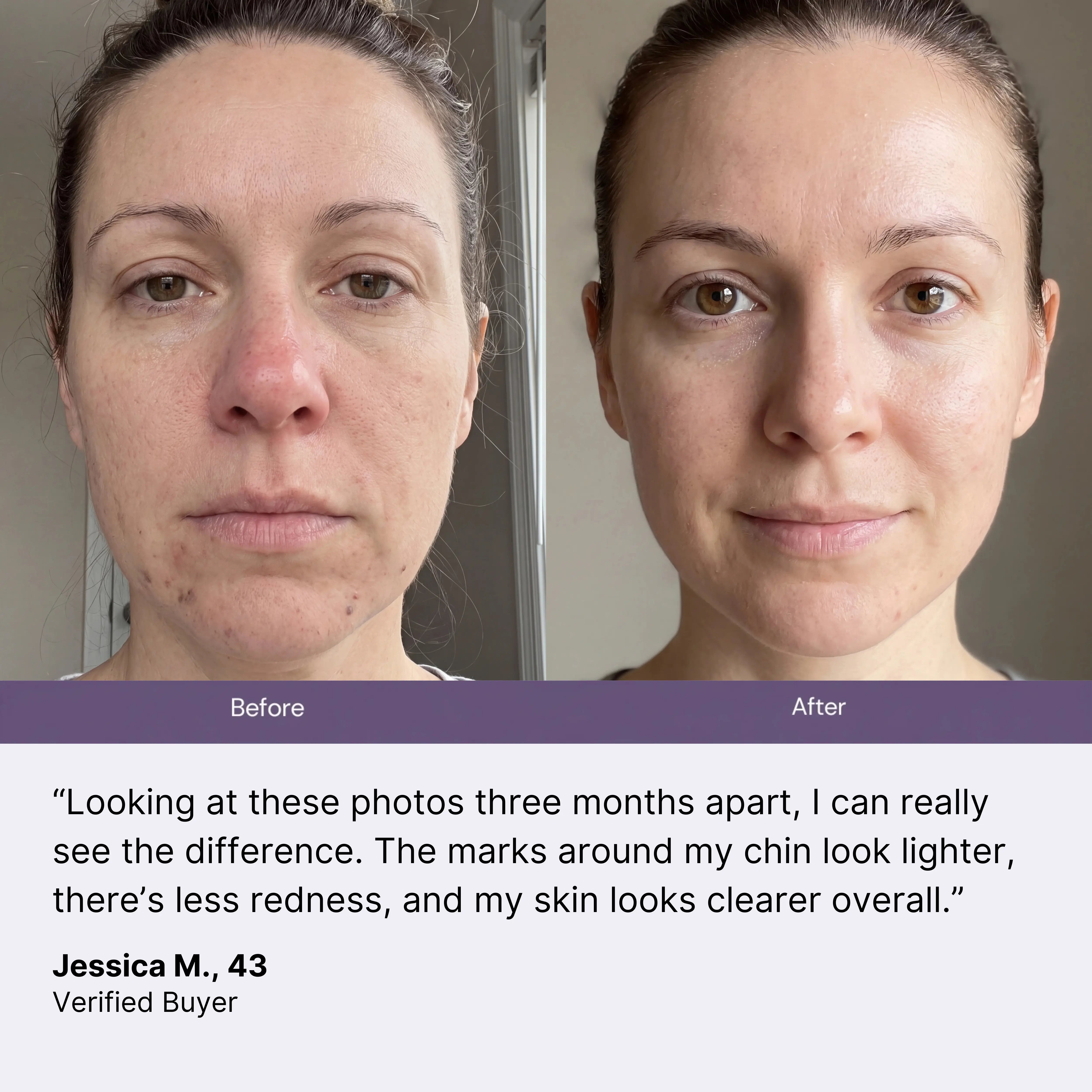 Meltgen Glow Strips
